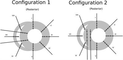 Directed graph mapping shows rotors maintain non-terminating and focal sources maintain self-terminating Torsade de Pointes in canine model
